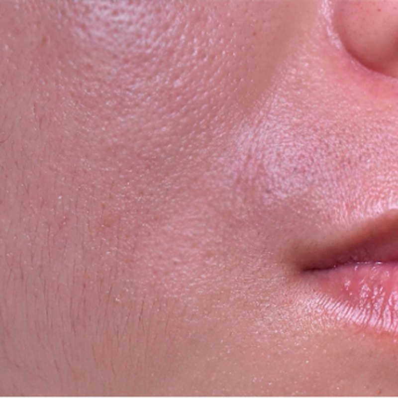 Oily & Combination Skin